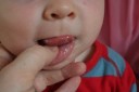 20100202_first_tooth_012