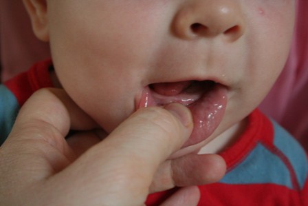 20100202_first_tooth_013