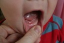 20100202_first_tooth_015